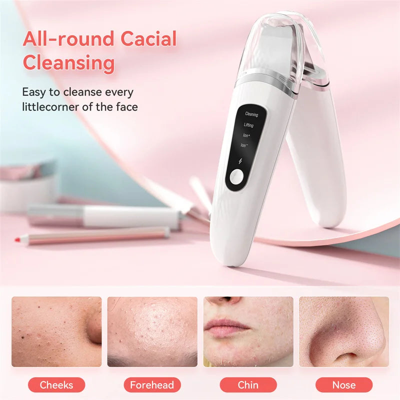 Ultrasonic Skin Scrubber – Deep Facial Cleansing, Exfoliator & Blackhead Remover